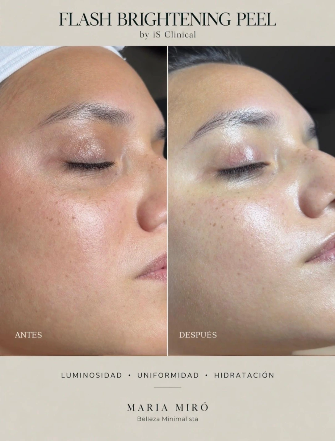 FLASH BRIGHTENING PEEL - Imagen 3